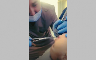 Годовалый ребенок проглотил 4-сантиметровый болт